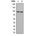 LifeSab™ PHF17 Rabbit pAb (50 µl)