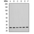 LifeSab™ DDAH2 Rabbit pAb (50 µl)