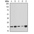 LifeSab™ PTRH2 Rabbit pAb (50 µl)