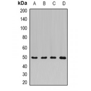 LifeSab™ ADSS Rabbit pAb (50 µl)