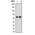 LifeSab™ CTNNBL1 Rabbit pAb (50 µl)