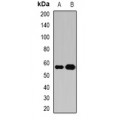 LifeSab™ Atase Rabbit pAb (50 µl)