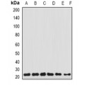 LifeSab™ Transgelin-2 Rabbit pAb (50 µl)