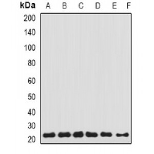 LifeSab™ Transgelin-2 Rabbit pAb (50 µl)
