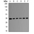 LifeSab™ Transaldolase Rabbit pAb (50 µl)