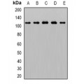 LifeSab™ AP2-alpha-1 Rabbit pAb (50 µl)