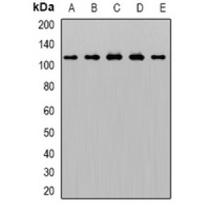 LifeSab™ AP2-alpha-1 Rabbit pAb (50 µl)