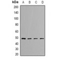 LifeSab™ DLST Rabbit pAb (50 µl)