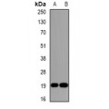 LifeSab™ DR1 Rabbit pAb (50 µl)