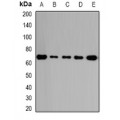 LifeSab™ GalNAc-T2 Rabbit pAb (50 µl)