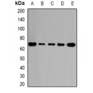 LifeSab™ GalNAc-T2 Rabbit pAb (50 µl)