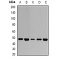 LifeSab™ GOT2 Rabbit pAb (50 µl)