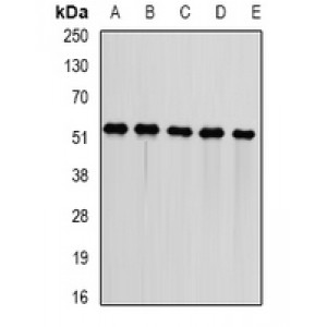 LifeSab™ DNAJA3 Rabbit pAb (50 µl)