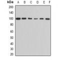 LifeSab™ ALDH1L1 Rabbit pAb (50 µl)