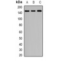 LifeSab™ Rent2 Rabbit pAb (50 µl)