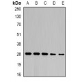 LifeSab™ NFU1 Rabbit pAb (50 µl)
