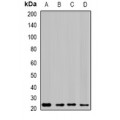 LifeSab™ GTL3 Rabbit pAb (50 µl)