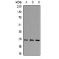 LifeSab™ BTEB1 Rabbit pAb (50 µl)
