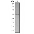 LifeSab™ SETD6 Rabbit pAb (50 µl)