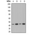 LifeSab™ ACAA1 Rabbit pAb (50 µl)