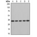 LifeSab™ AUH Rabbit pAb (50 µl)