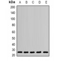 LifeSab™ PSPH Rabbit pAb (50 µl)