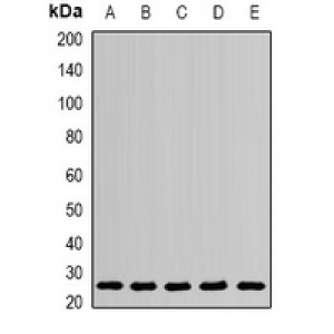 LifeSab™ PSPH Rabbit pAb (50 µl)