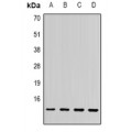 LifeSab™ SSNA1 Rabbit pAb (50 µl)