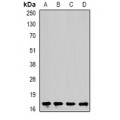 LifeSab™ Cofilin 2 Rabbit pAb (50 µl)