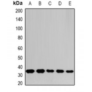 LifeSab™ THOC1 Rabbit pAb (50 µl)