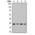 LifeSab™ CHMP1B Rabbit pAb (50 µl)