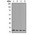 LifeSab™ nm23-H4 Rabbit pAb (50 µl)