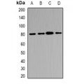 LifeSab™ ABCB8 Rabbit pAb (50 µl)
