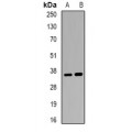 LifeSab™ ACP5 Rabbit pAb (50 µl)