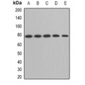 LifeSab™ ACAS2 Rabbit pAb (50 µl)