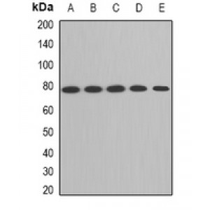 LifeSab™ ACAS2 Rabbit pAb (50 µl)