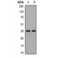 LifeSab™ ADH5 Rabbit pAb (50 µl)