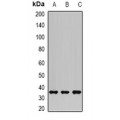 LifeSab™ AKR1C3 Rabbit pAb (50 µl)