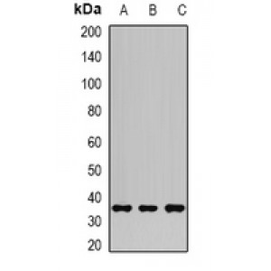 LifeSab™ AKR1C3 Rabbit pAb (50 µl)
