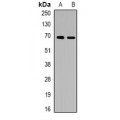 LifeSab™ ALB Rabbit pAb (50 µl)
