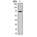 LifeSab™ ALB Rabbit pAb (50 µl)