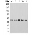LifeSab™ Annexin A11 Rabbit pAb (50 µl)
