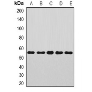 LifeSab™ Annexin A11 Rabbit pAb (50 µl)