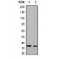 LifeSab™ CD151 Rabbit pAb (50 µl)
