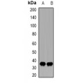 LifeSab™ CDK20 Rabbit pAb (50 µl)