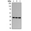 LifeSab™ CDK6 Rabbit pAb (50 µl)