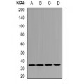 LifeSab™ DHRS9 Rabbit pAb (50 µl)