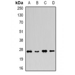 LifeSab™ FGF14 Rabbit pAb (50 µl)