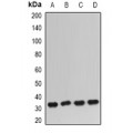 LifeSab™ IGFBP5 Rabbit pAb (50 µl)