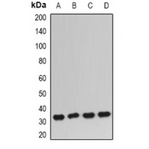 LifeSab™ IGFBP5 Rabbit pAb (50 µl)